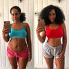 Resultados visibles antes y después en abdomen de mujer tras tratamiento con Vibro Sculpt.