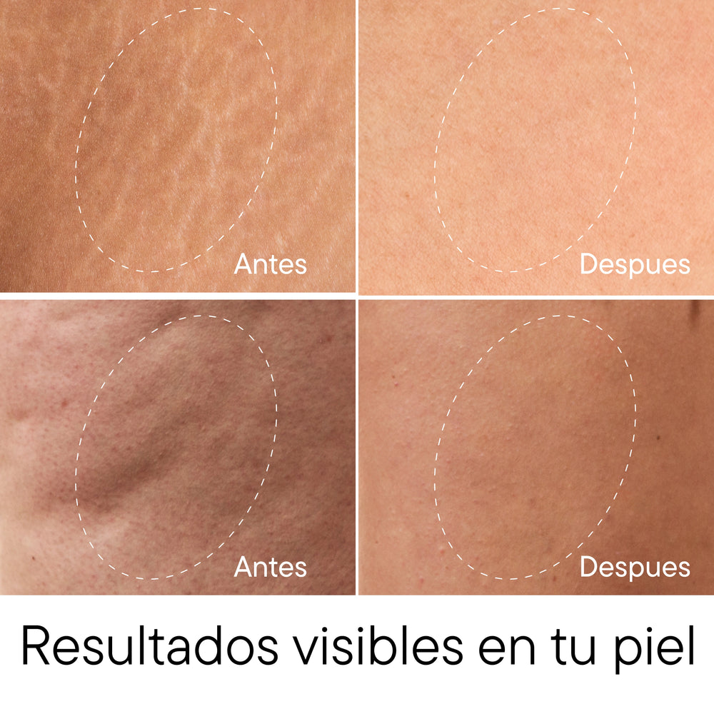 Hielo Mineral